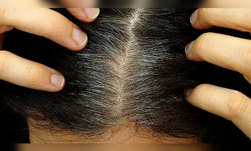 Saiba quais alimentos retardam o envelhecimento dos fios