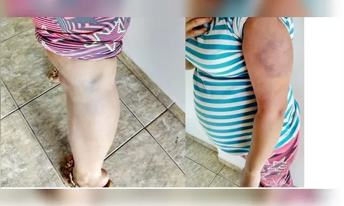 Foragido da Justiça é preso após agredir mulher grávida de sete meses