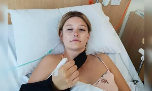 Moça de 20 anos tem dedo amputado após adquirir câncer por roer unhas em razão de bullying na escola