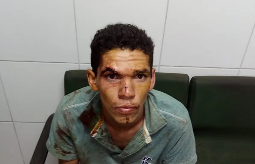 Rapaz de 22 anos esfaqueia mãe grávida, mata cachorro e come pedaço do coração do animal​​ - Foto: Reprodução/Whatsapp/Tribuna do Ceará​