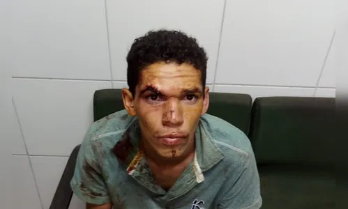 Rapaz de 22 anos esfaqueia mãe grávida, mata cachorro e come pedaço do coração do animal