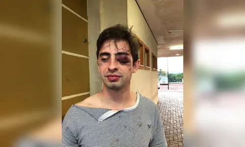 Seguranças são acusados de espancar jovem dentro de casa noturna em Londrina