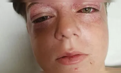 
							Menino de 11 anos fica gravemente ferido em novo desafio na internet; veja vídeo
						
						