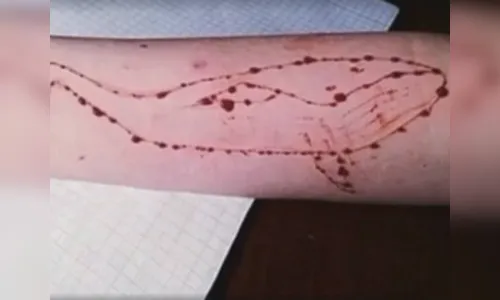 
							Menino de 11 anos fica gravemente ferido em novo desafio na internet; veja vídeo
						
						