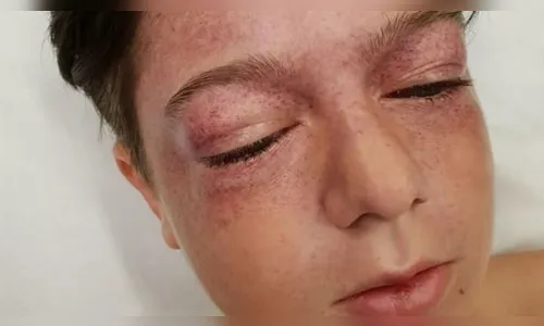 
							Menino de 11 anos fica gravemente ferido em novo desafio na internet; veja vídeo
						
						