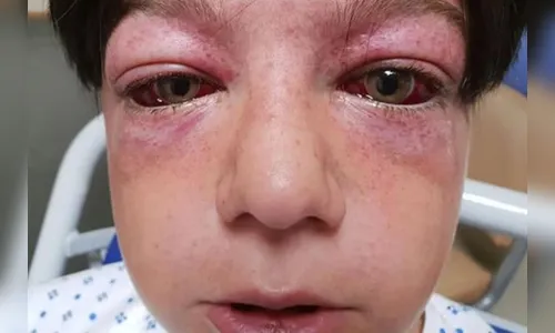 Menino de 11 anos fica gravemente ferido em novo desafio na internet; veja vídeo