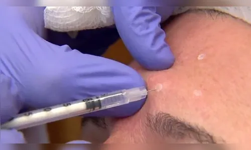 Em Hong Kong, mulher morre por overdose de botox