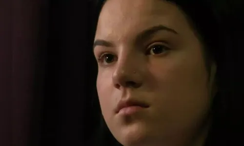 Após deixar filhos em berçário, mulher é levada para floresta pelo marido e tem mãos amputadas com machado