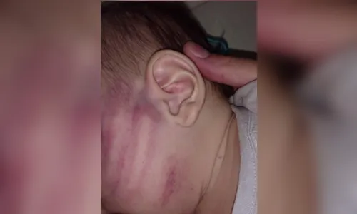 Polícia prende pai de 22 anos suspeito de agredir o filho bebê de 5 meses