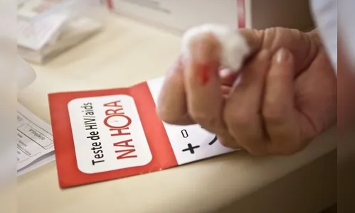 Aids: casos e óbitos caem 16% nos últimos quatro anos no Brasil