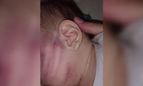 Preso sob suspeita de espancar o filho de 5 meses, pai confessa o crime