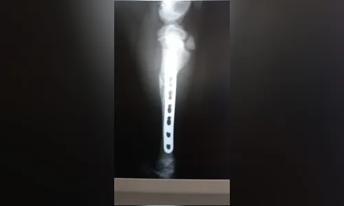 
							Jhony para adoção
						
						