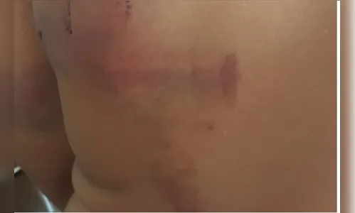 
							Padrasto é preso após espancar o enteado de 11 anos em Faxinal
						
						