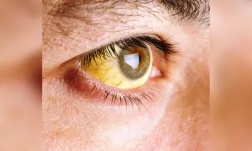 Paraná confirma primeira morte por febre amarela em 2019