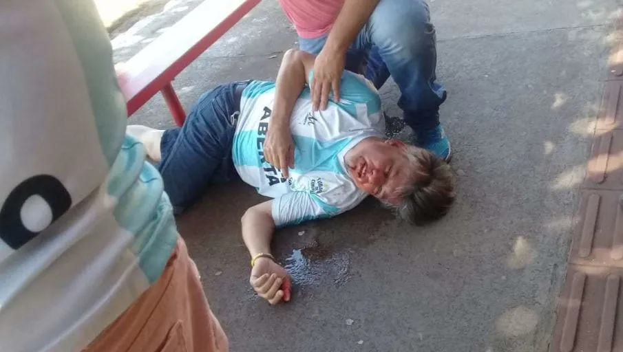 Boca Aberta ficou ferido no nariz (Foto: WhatsApp)