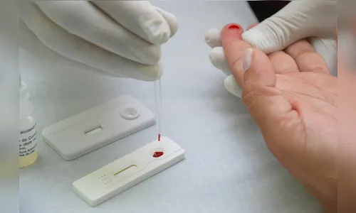 Saúde realizou 1.682 exames no período de três meses