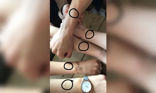 Desafio na internet mostra que maioria das mulheres tem pinta no pulso