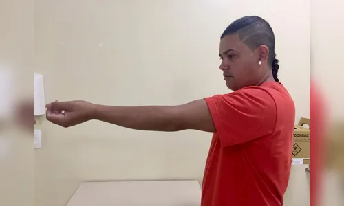 Cirurgia rara de cotovelo devolve movimento a paciente