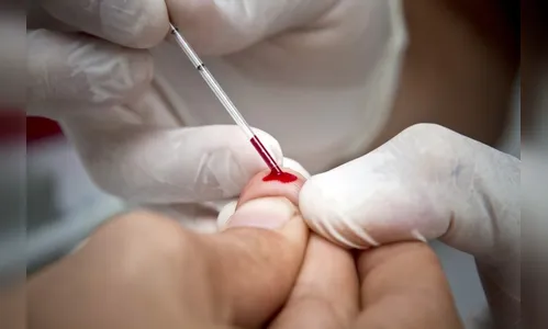 Campanha realiza teste gratuito de hepatite em Ivaiporã