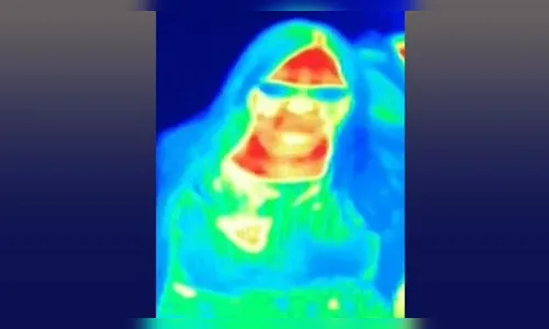 Mulher descobre câncer de mama em câmera térmica de atração turística