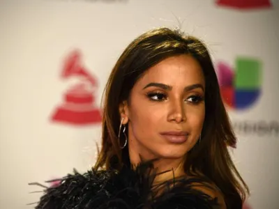 Anitta diz que quer ter 'boca de metida' e realiza procedimento estético