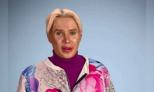 Fã gasta R$ 1 milhão para ter rosto de cantor de BTS e corre risco de perder o nariz