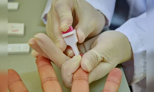 135 mil brasileiros vivem com aids sem saber da doença