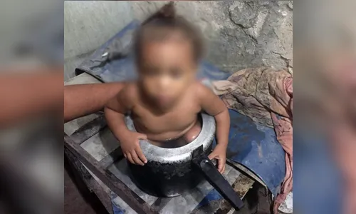 Criança fica presa dentro de panela de pressão e é resgatada por Bombeiros no Recife
