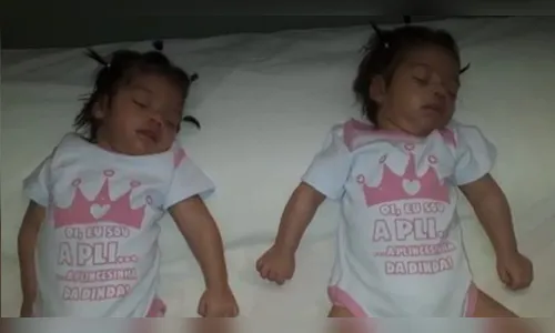 Gêmeas que só dormem desde que nasceram têm risco de sequelas; irmãs são do interior do Pará