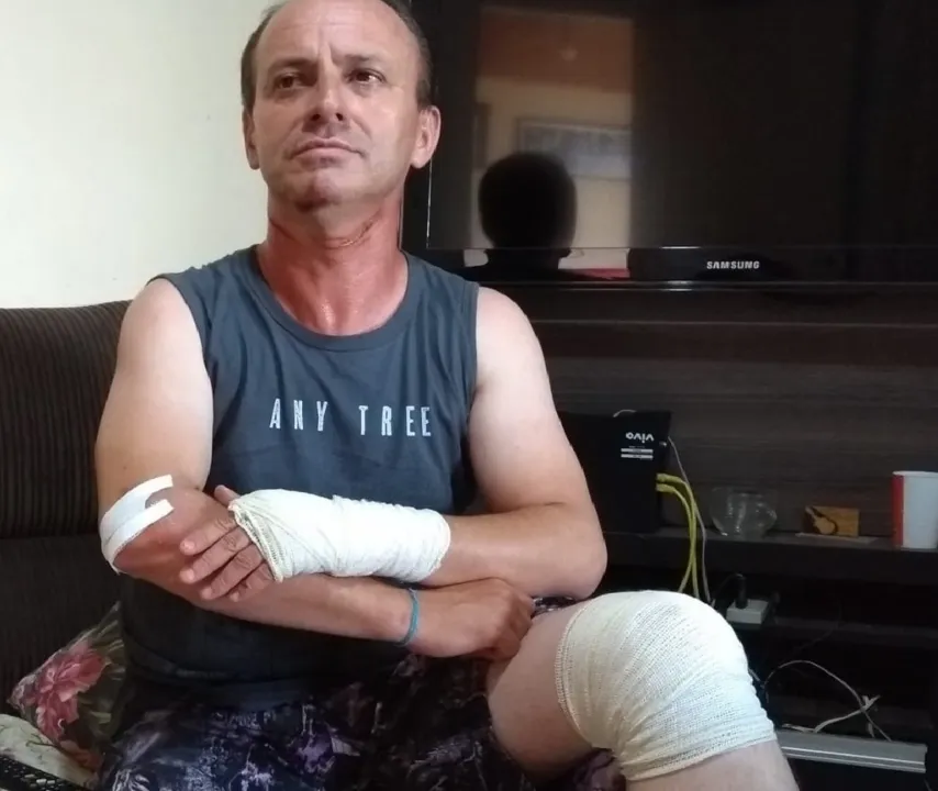 Cezar Neves ficou ferido após enroscar em um fio telefônico (Arquivo pessoal)