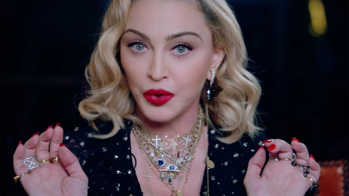Madonna cancela show de turnê por conta de dor “indescritível”
