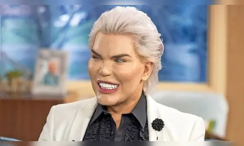 Rodrigo Alves, o Ken humano, assume transexualidade: “queria ser a Barbie”