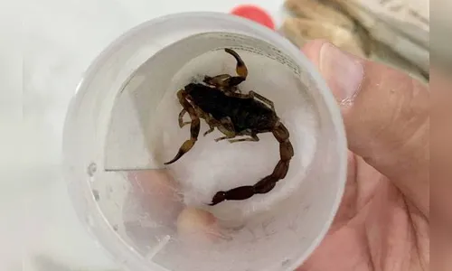 Você sabe o que fazer em caso de picada de animal peçonhento? Especialista explica como agir