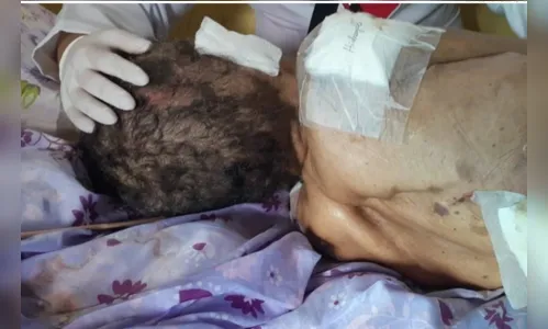 Idosa é encontrada ferida, suja e em condições insalubres em casa no DF; filha foi presa