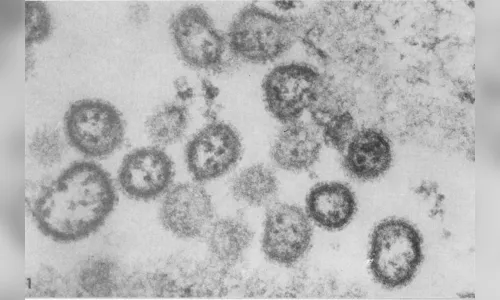 Novo vírus provoca primeiro caso de febre hemorrágica brasileira em 20 anos