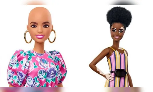 Barbie terá bonecas carecas e com vitiligo