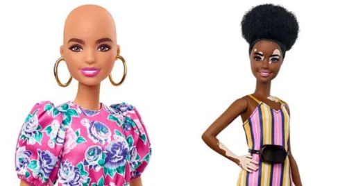 Barbie terá bonecas carecas e com vitiligo