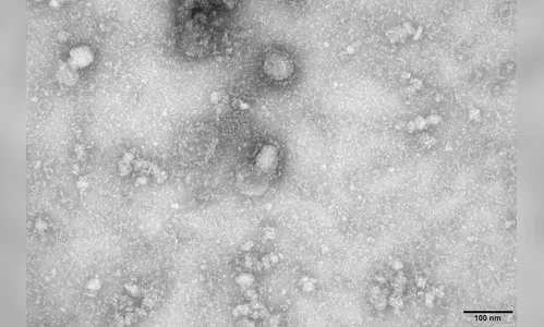 Número total de mortes em decorrência do coronavírus ultrapassa 360