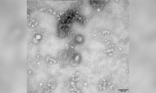 Sanitarista tranquiliza foliões sobre risco de coronavírus no carnaval