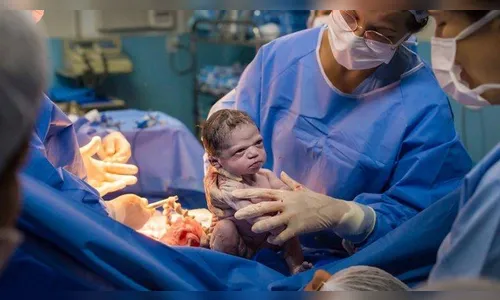 Bebê nasce com expressão ‘zangada’ e imagem viraliza na internet