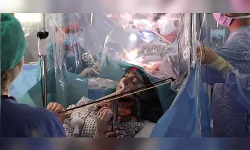 Paciente toca violino enquanto faz cirurgia para preservar movimentos