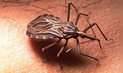 Saúde promove capacitação sobre a doença de Chagas