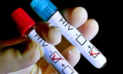 Casos de HIV sobem 43,4% na região