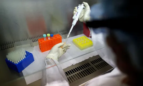Em 24 horas, país tem 3,3 mil novos casos e 189 mortes por covid-19 