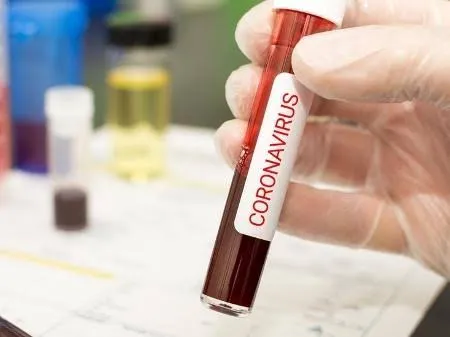 Paraná tem 54 casos confirmados do novo coronavírus 