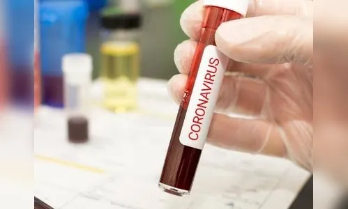 Paraná tem 54 casos confirmados do novo coronavírus 