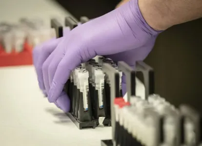 Região tem 8 casos confirmados do novo coronavírus e 16 suspeitos