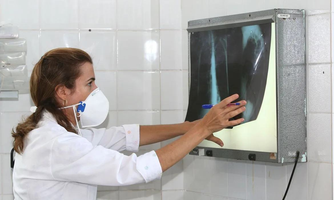 OMS: tratamento da tuberculose não deve ser descuidado