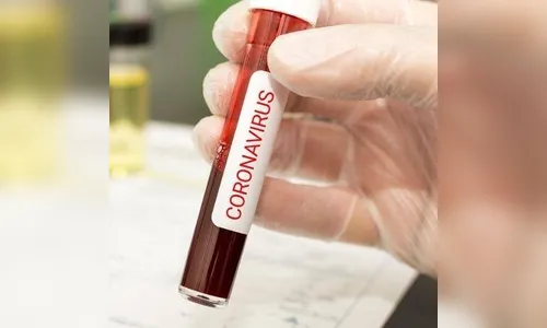 Jandaia do Sul descarta suspeita de coronavírus