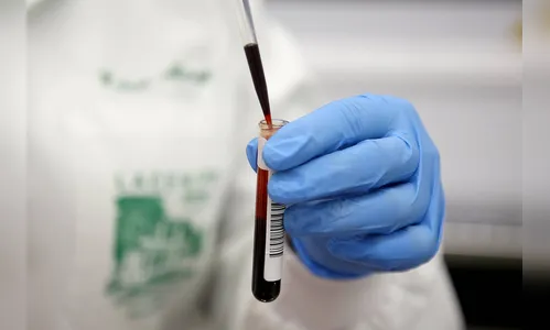 Saiba como é feito o exame para detectar o novo coronavírus no Paraná